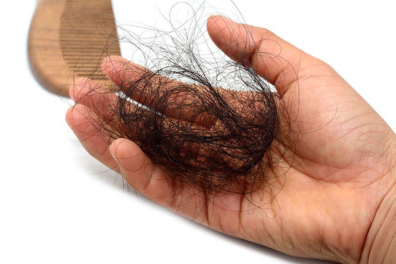 Cortisol levels – which can be lowered with CBD – put hair follicles into a prolonged resting phase, and the affected hair strands fall out during brushing and washing. Photo by Wendy Burchfield via Creative Commons/ CC BY 2.0 Deed